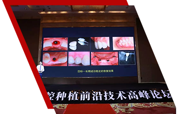 【20190828】讓探索進(jìn)行，讓改變發(fā)生 I 2019口腔種植前沿技術(shù)高峰論壇圓滿(mǎn)落幕